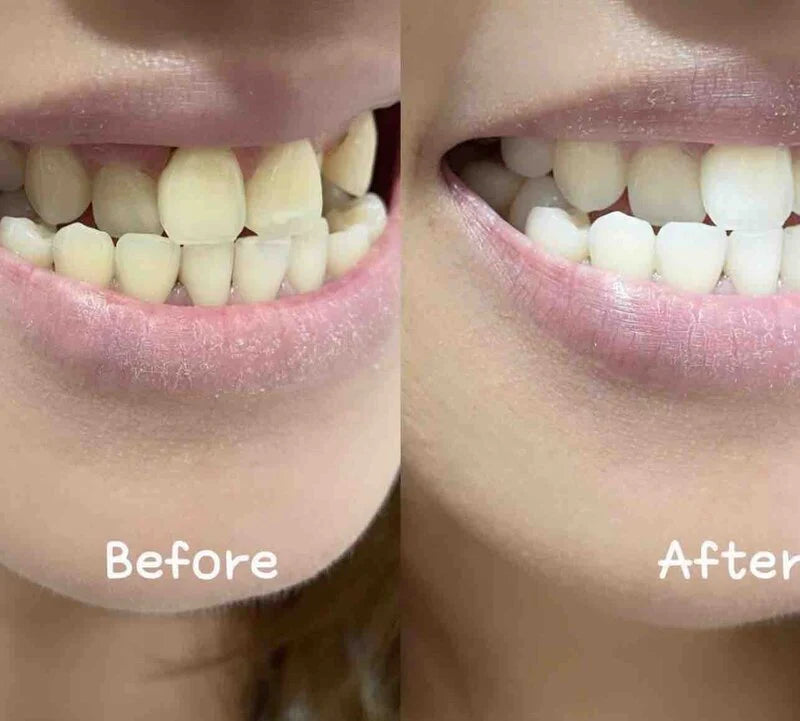 New Smile - 全新益生菌光感美白牙膏