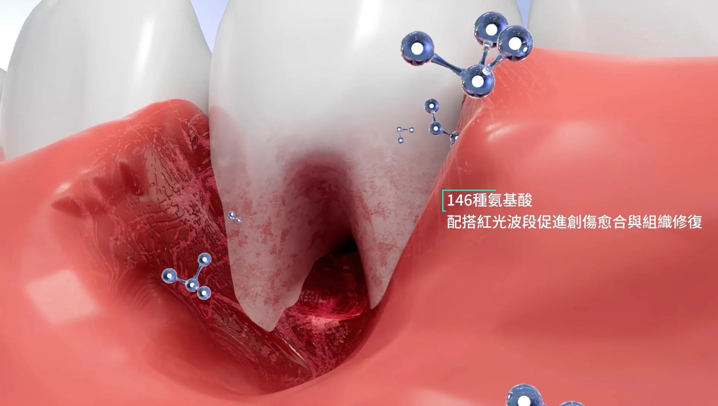 New Smile LED 第五代增量版納米護牙美白組合 - #不傷琺瑯質 #1️⃣星期提升牙齒美白度 #無氟 #牙周病 #敏感牙齒 #藍光保護霜
